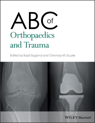 ABC of Orthopaedics and Trauma (ePub eBook)